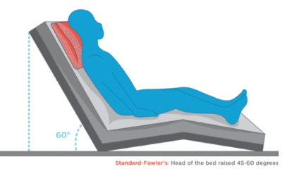 What Are The Patient Positions In Medical Bed